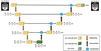 Automatic segmentation of nasopharyngeal carcinoma on CT images using efficient UNet‐2.5D ensemble with semi‐supervised pretext task pretraining